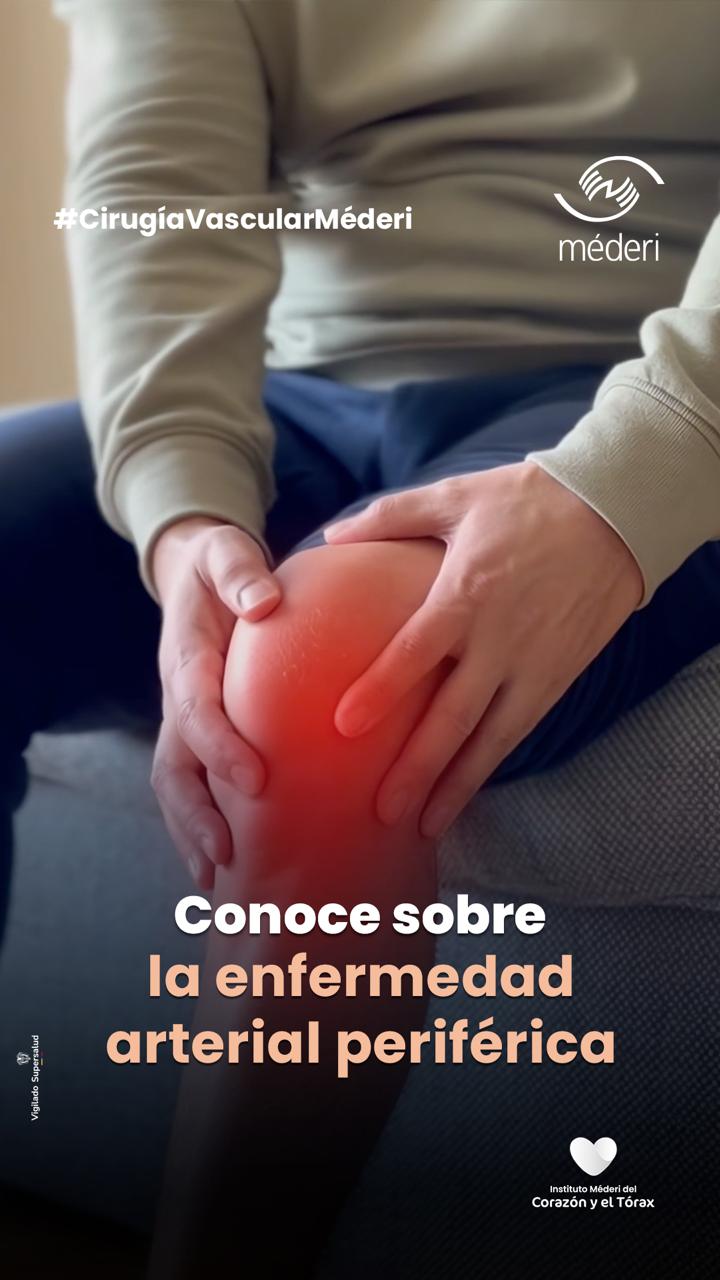 Paciente con dolor en extremidad inferior relacionado con enfermedad arterial periférica en Méderi.