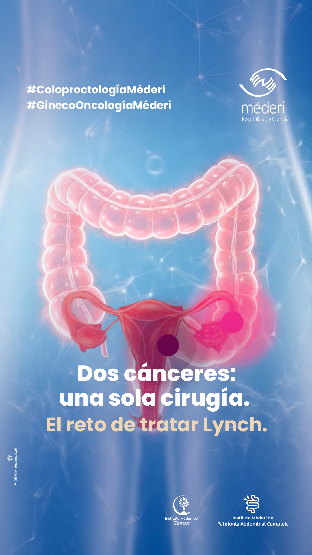 Ilustración médica sobre el abordaje quirúrgico en pacientes con síndrome de Lynch en la Red Hospitalaria Méderi.