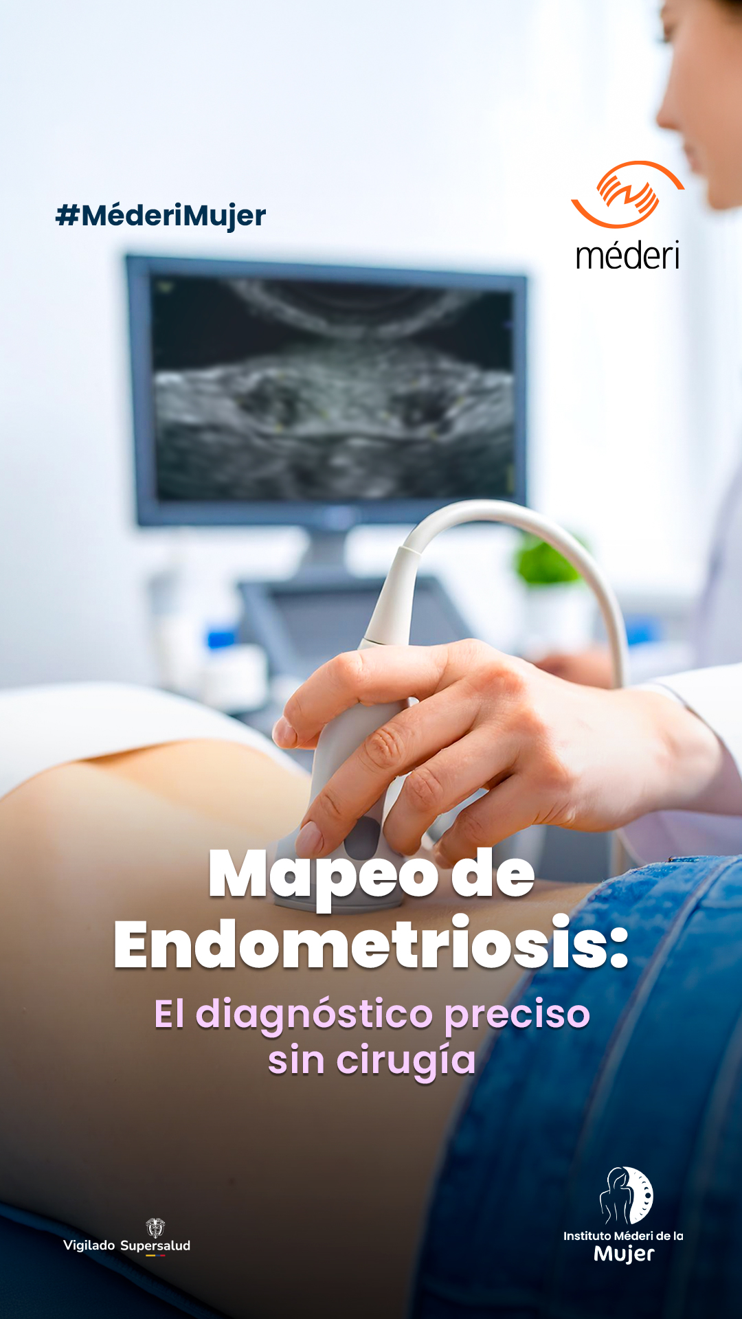Procedimiento de ecografía especializada para el mapeo de endometriosis en el Instituto Méderi de la Mujer.