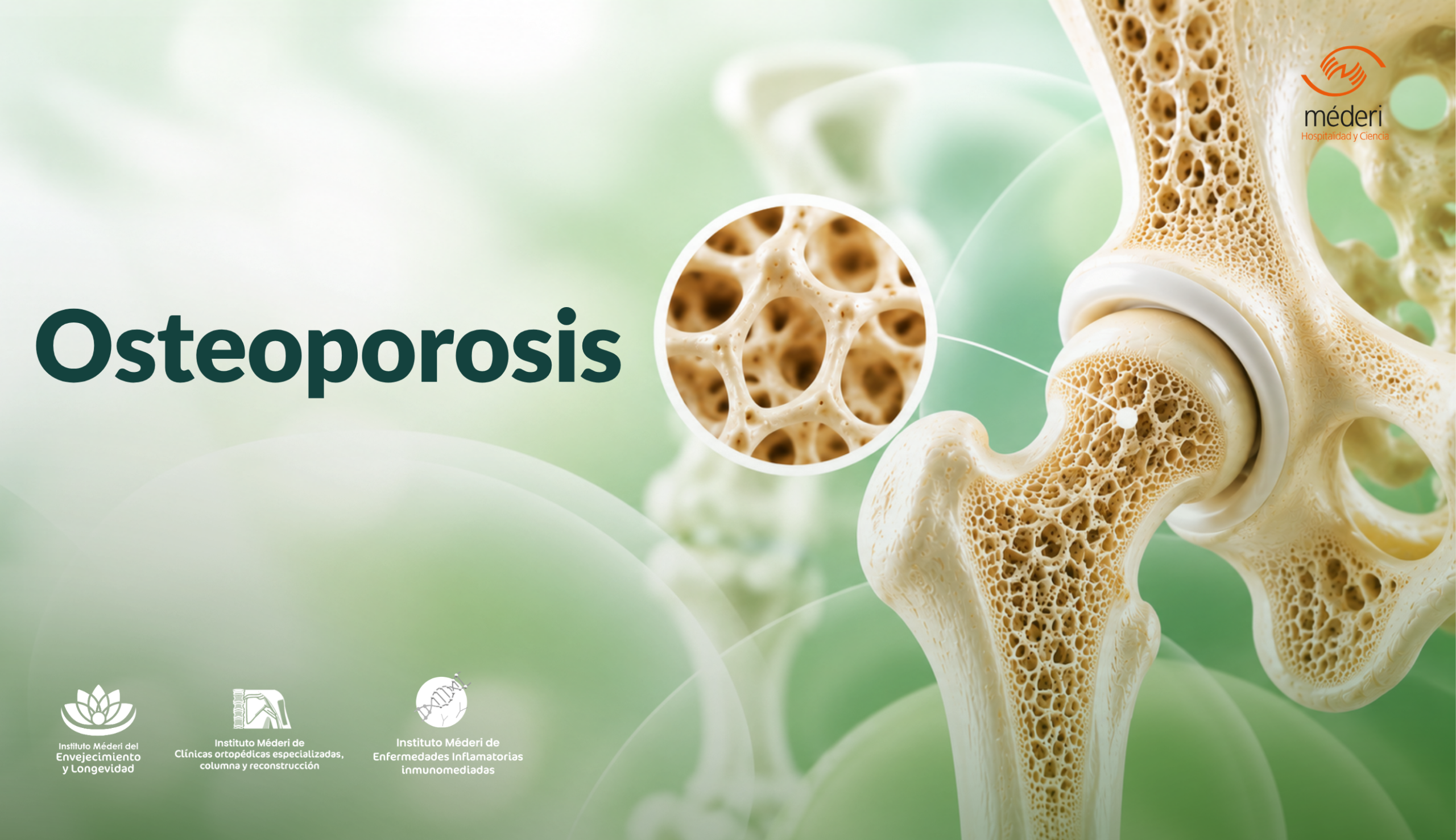 Ilustración médica de la estructura ósea y cadera que explica qué es la osteoporosis y la pérdida de densidad en los huesos.